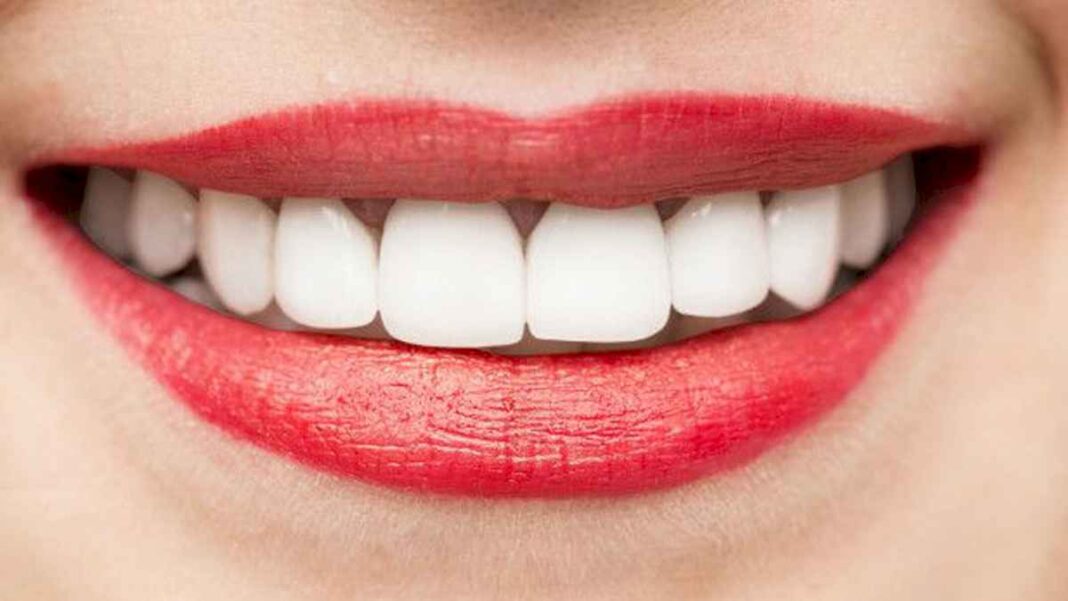 la-infusion-que-se-toma-tres-veces-por-dia-y-elimina-el-sarro-de-los-dientes