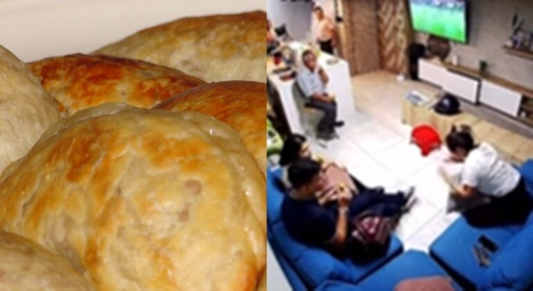 Por comer una empanada, una joven terminó con graves quemaduras y un tratamiento que duró un mes