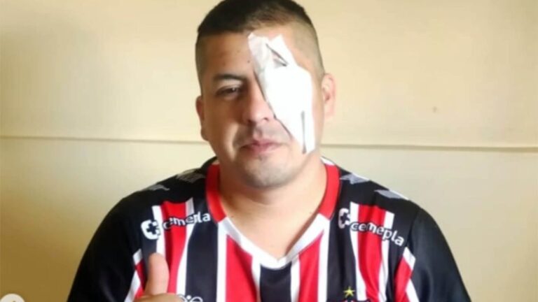 Hincha de Chacarita perdió la visión de un ojo por la brutal represión en Congreso