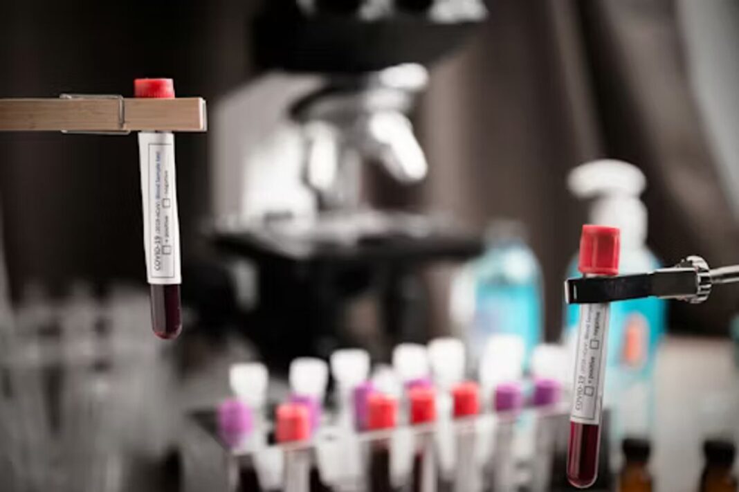 Muestra de sangre en laboratorio del Hospital Posadas para análisis de grupo Gerbich negativo