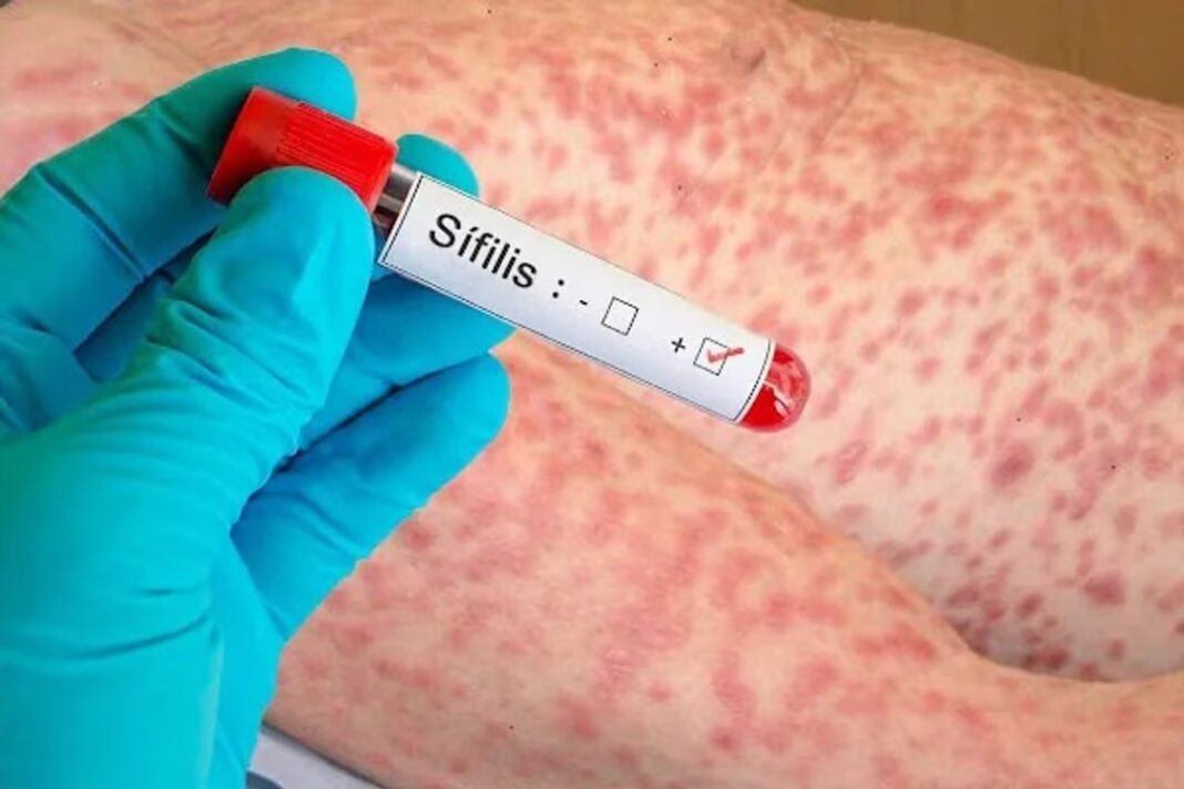 Campaña de testeos gratuitos de VIH y sífilis en el Hospital Regional de Comodoro Rivadavia