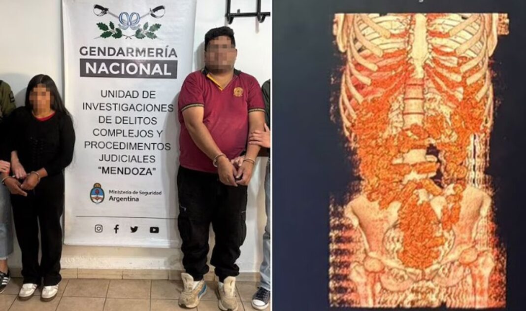 Escáner corporal en Aeroparque donde se detectaron las cápsulas de cocaína